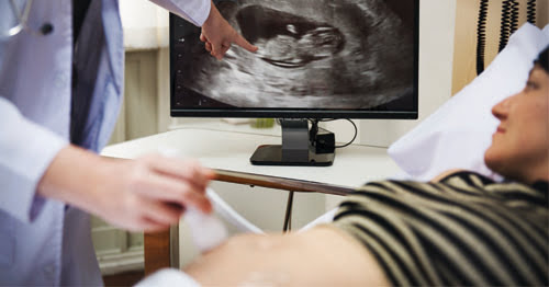 Mujer embarazada en el hospital realizando una ecografía.