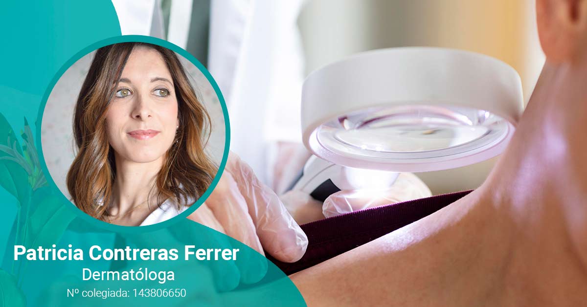 Dermatóloga explica los factores desencadenantes de la psoriasis