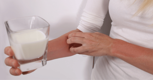 Mujer con picazón en el brazo sosteniendo un vaso de leche.