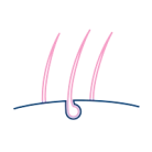 Exceso de vello - PCOS Niam